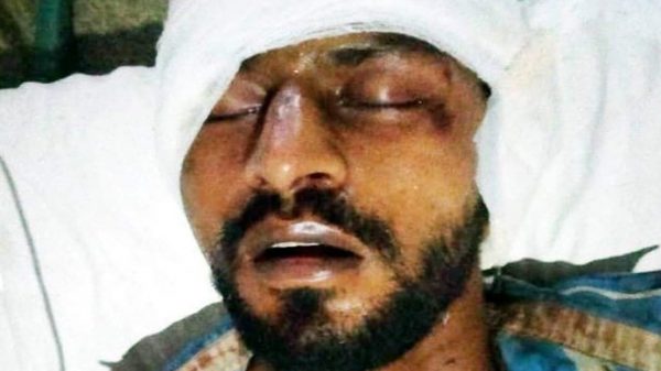 জীবনমৃত্যুর সন্ধিক্ষণে রাইডার রাজু, গ্রেফতার হয়নি অপহরণকারীরা - Natun Sylhet