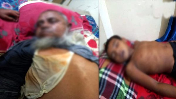 কানাইঘাটে বিদ্যুৎস্পৃষ্টে দাদা নাতি নিহত - Natun Sylhet
