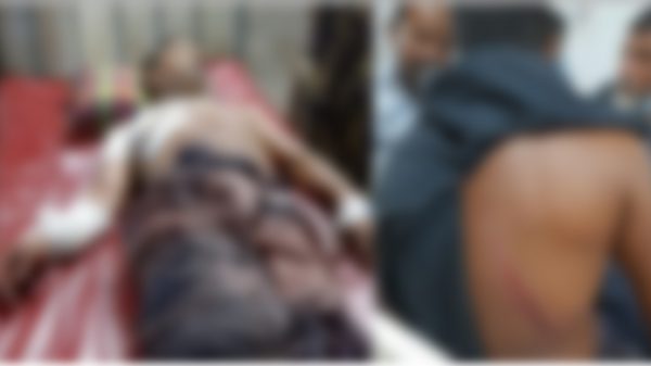 ছাতকে প্রতিপক্ষের হামলায় দুই সহোদরসহ আহত ৩ - Natun Sylhet