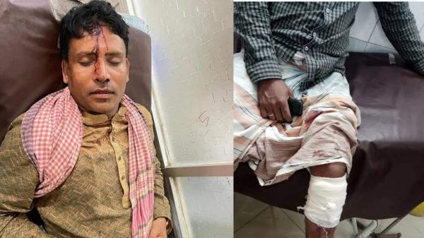 কোম্পানীগঞ্জে সংঘর্ষে ইউপি চেয়ারম্যান সহ ৩ জন আহত - Natun Sylhet