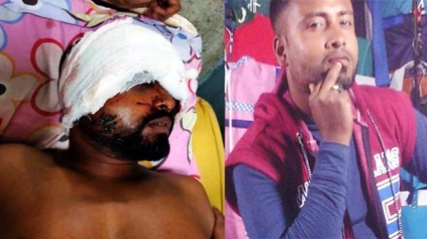 বালাগঞ্জে সন্ত্রাসী হামলায় চোখ হারালেন হামিদ - Natun Sylhet