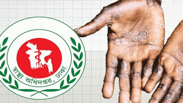 ‘মাঙ্কিপক্স’ নিয়ে দেশের সব বন্দরে সতর্কতা জারি - Natun Sylhet