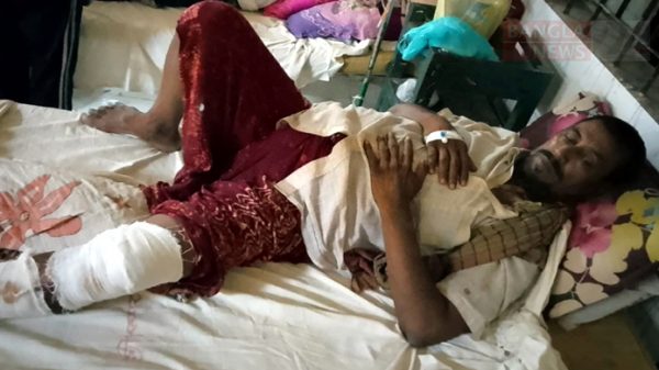 এক ব্যক্তিকে পিটিয়ে পা ভেঙে দিলেন পুলিশ কর্মকর্তা - Natun Sylhet
