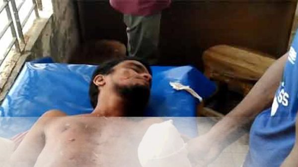 ঘুমন্ত স্বামীর দুই হাতের কবজি বিচ্ছিন্ন করলেন স্ত্রী! - Natun Sylhet