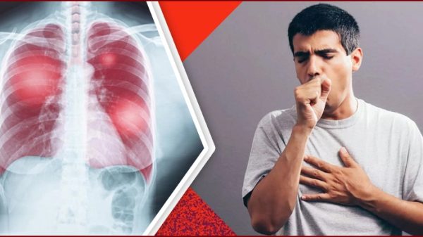 নিউমোনিয়ার যে লক্ষণ এড়িয়ে গেলেই বিপদ! - Natun Sylhet